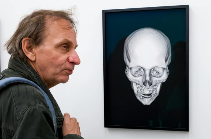 L'écrivain Michel Houellebecq devant une radio de son crâne à l'exposition "Manifesta 11" le 10 juin 2016 à Zürich
