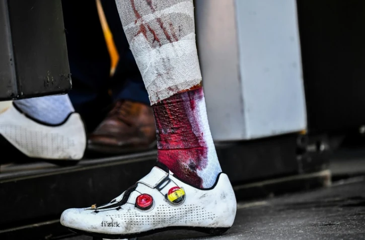 Le Belge Philippe Gilbert la jambe en sang en raison d'une chute lors de la 16e étape du Tour de France, le 24 juillet 2018 entre  Carcassonne et Bagnères-de-Luchon