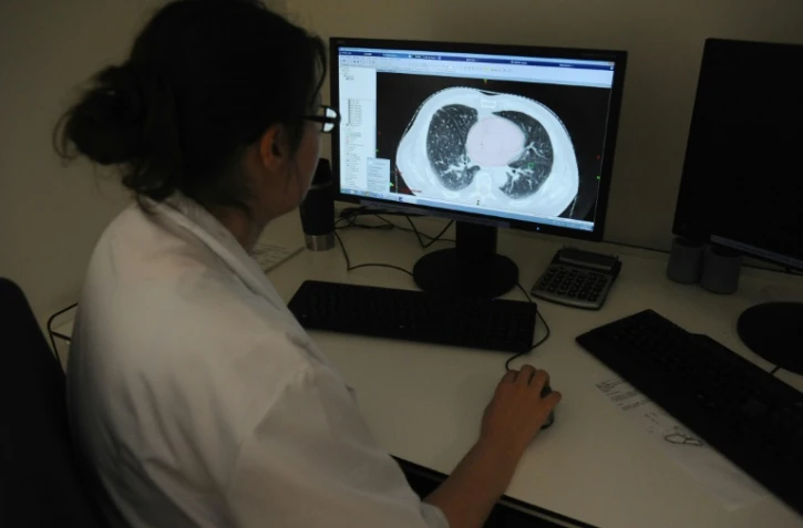 Un médecin regarde une raio des poumons à l'Institut Universitaire du Cancer de Toulouse (IUCT) le 4 juin 2015