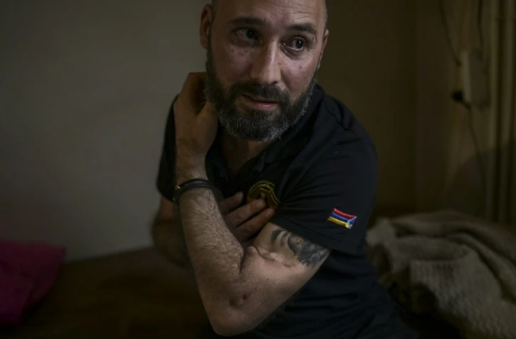 Serguei Davidian, 39 ans, montre ses blessures datant de la guerre de 2020 au Haut-Karabakh, à Erevan le 3 octobre 2023