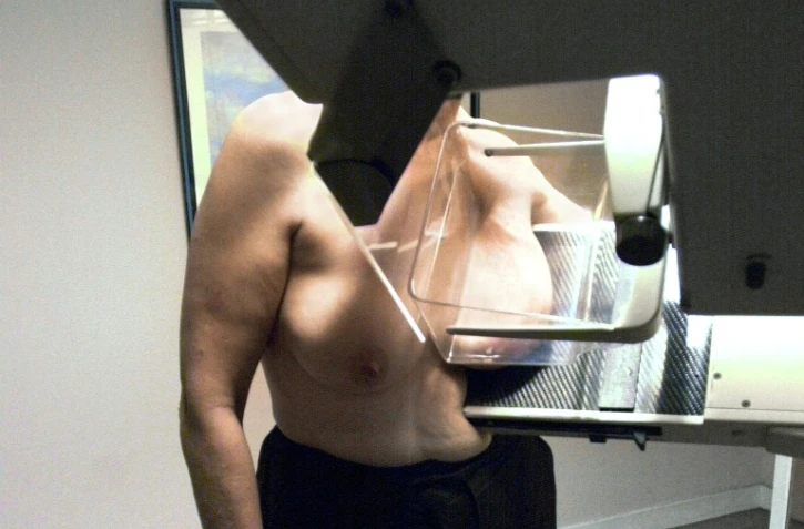 La mammographie victime de la même défiance que les vaccins, amplifiée par les réseaux sociaux? Les gynécologues français s'inquiètent de la baisse du dépistage du cancer du sein, qui conduit des patientes à consulter trop tard.