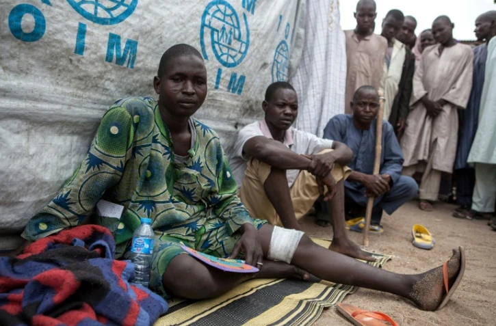 Un homme blessé par un engin explosif, devant sa tente à Banki (nord-est du Nigeria), le 26 avril 2017