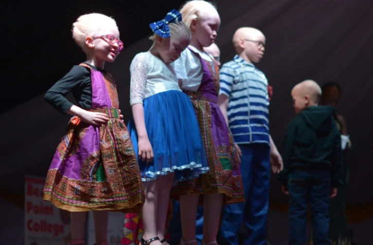 Des enfants albinos participent à l'élection des premiers Miss et Mister Albinisme Kenya, le 21 octobre 2016 à Nairobi