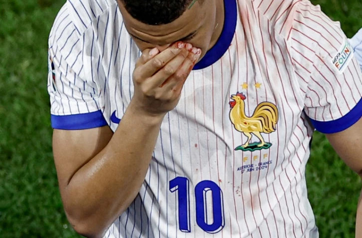 L'attaquant français Kylian Mbappé quitte le terrain après s'être cassé le nez lors d'un choc pendant le match du groupe D de l'Euro 2024 contre l'Autriche à Düsseldorf, le 17 juin 2024