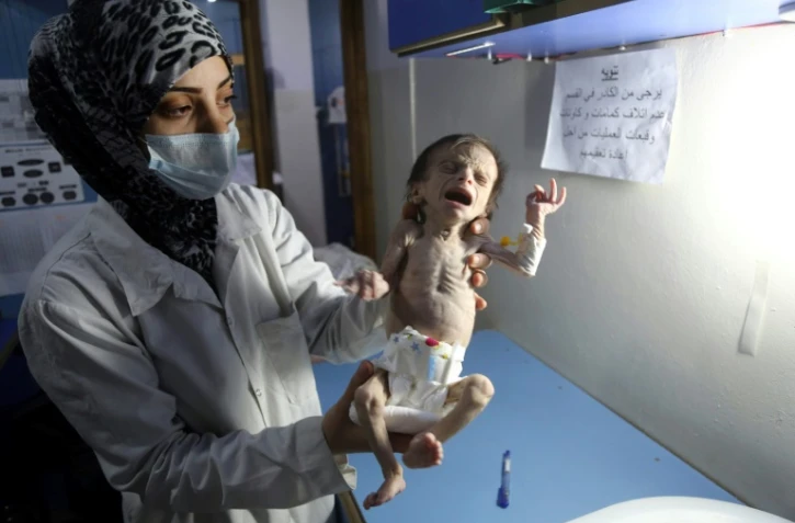 Une infirmière porte une petite fille syrienne souffrant de malnutrition aiguë, le 21 octobre 2017 dans un hôpital de Hamouria, dans la Ghouta orientale