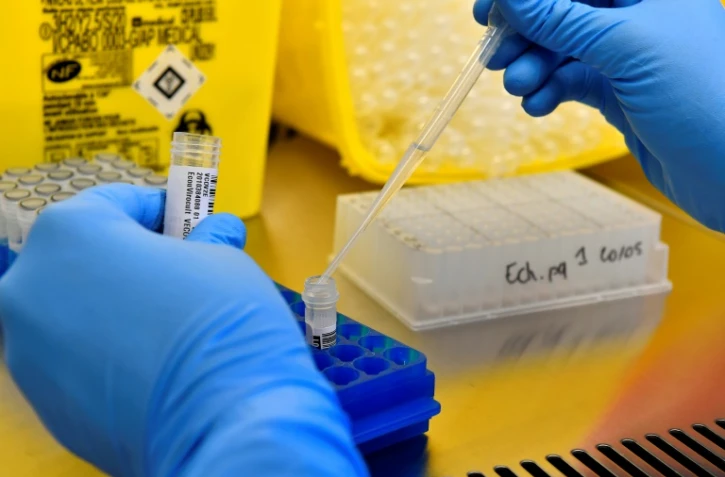 Les tests Covid ne sont plus gratuits en France 