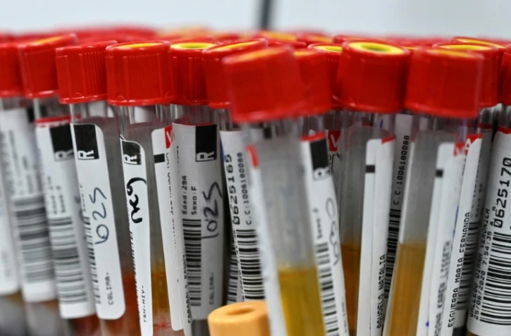 La question de l'immunité et de la protection contre le Covid-19 est encore mal comprise par les chercheurs