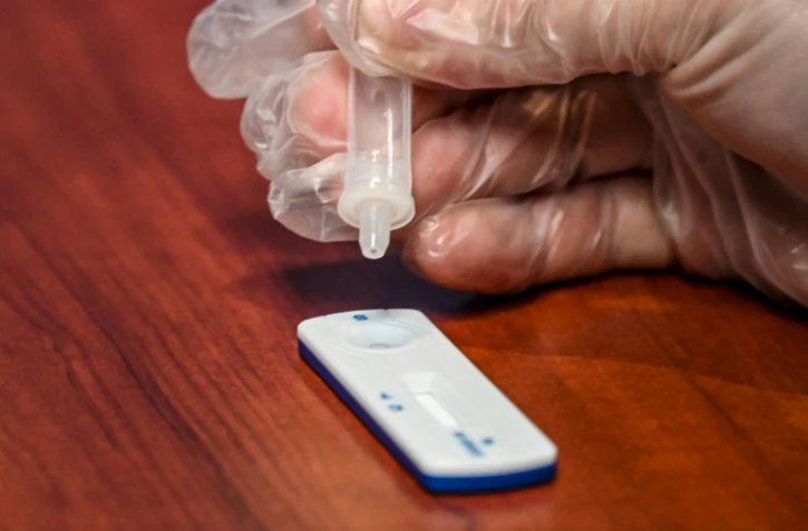 Neuf premiers cas de Covid-19 ont été détectés dimanche en Nouvelle-Calédonie où un confinement strict de deux semaines a été annoncé par le président du gouvernement local et le haut-commissaire de la République