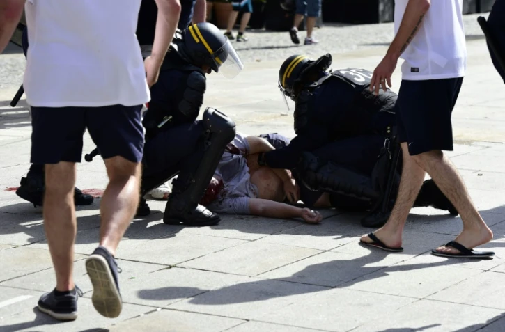 Le supporteur anglais Andrew Bache après avoir été frappé par un hooligan russe, lors de l'Euro le 11 juin 2016 à Marseille