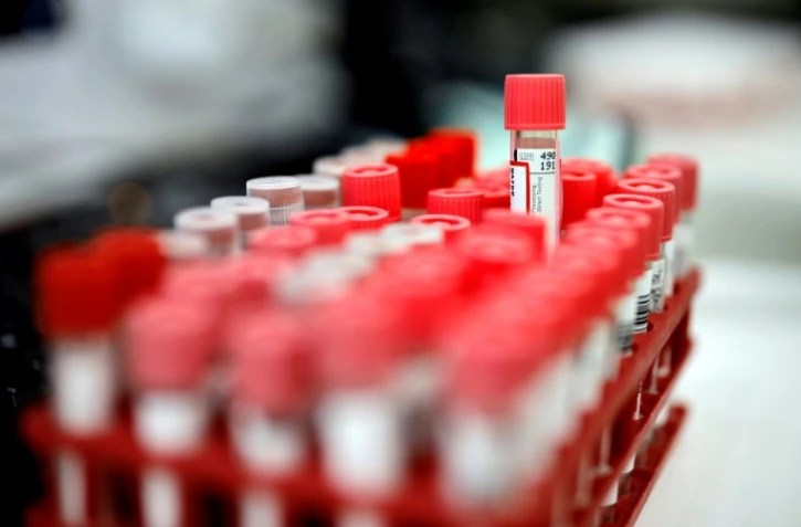 Tests sérologiques pour rechercher le Covid-19 analysés par un laboratoire en région parisienne, le 22 avril 2020