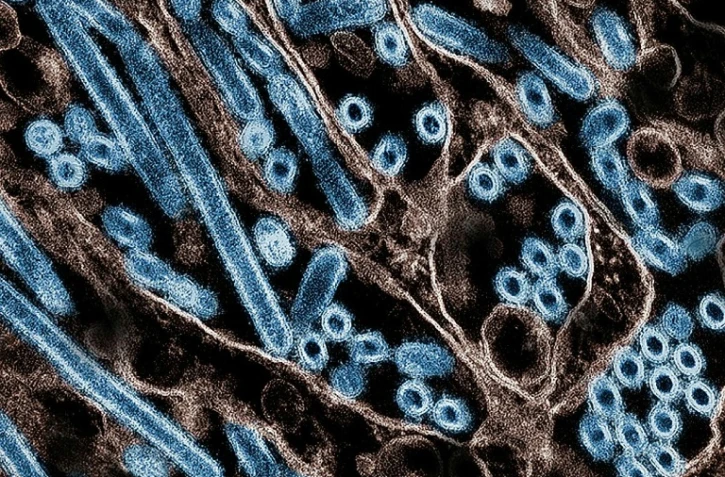 Pour la première fois, la grippe aviaire a tué un patient humain aux Etats-Unis. Plusieurs experts estiment depuis des mois que les autorités sanitaires américaines ne prennent pas assez la mesure de cette menace de santé publique