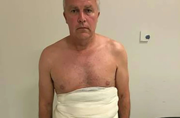 Photographie non datée diffusée par les autorités britanniques du trafiquant Jeffrey Lendrum transportant sur lui des oeufs d'espèces d'oiseaux rares après son arrestation à l'aéroport de Londres-Heathrow le 26 juin 2018