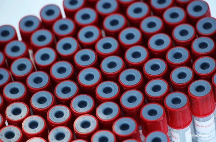Test coronavirus
