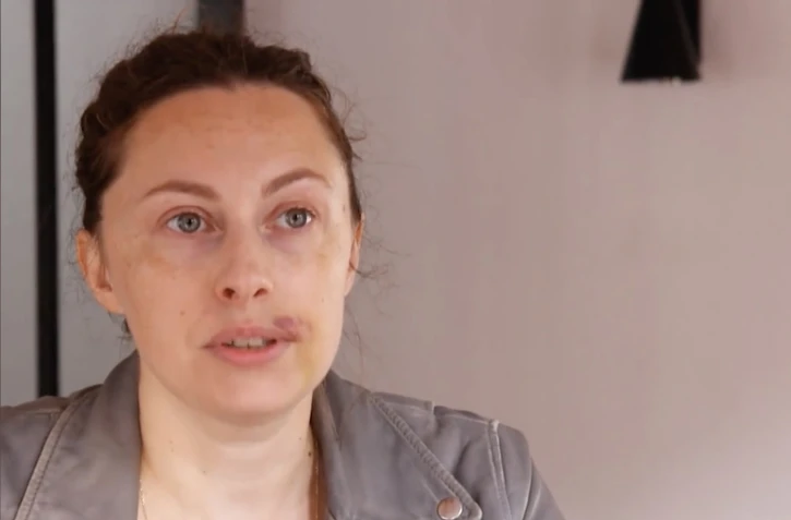 Femme agressée